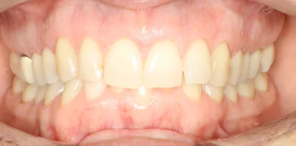 Patient-01-before