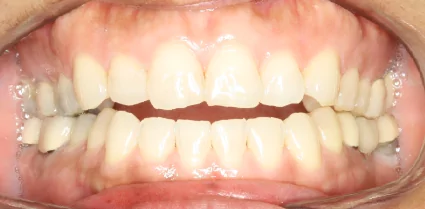 Patient-03-before
