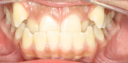 patient-02-before